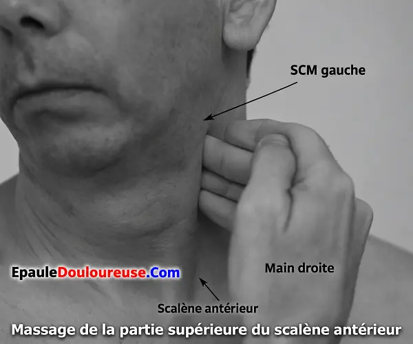 Massage de la partie supérieure du scalène antérieur